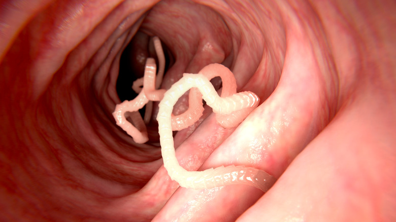 tapeworm in digestive tract