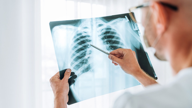 doctor examining chest x-ray