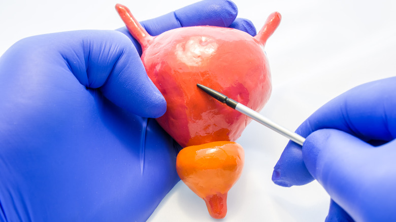 Doctor holding bladder anatomical model