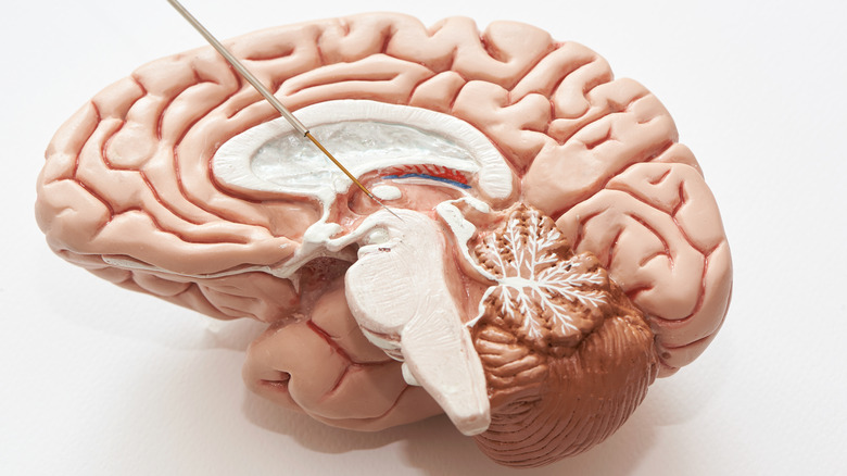 deep brain stimulation model