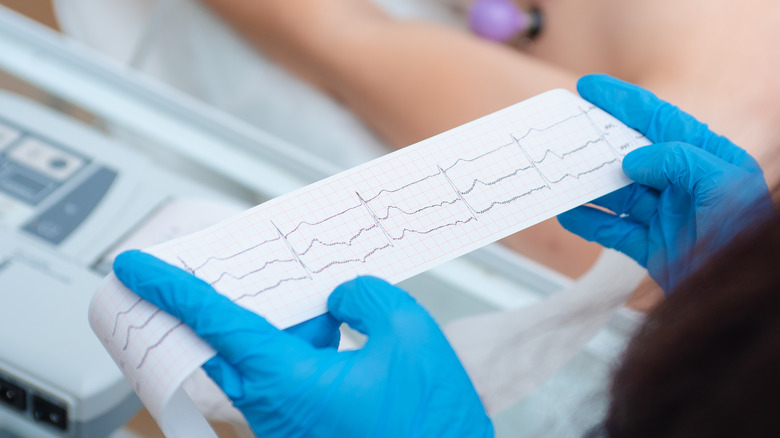 doctor reading results of electrocardiogram 