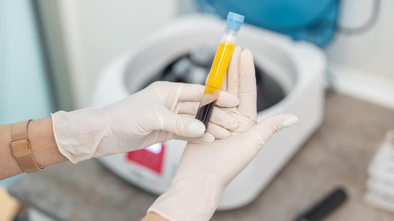 Gloved hands holding blood sample vial