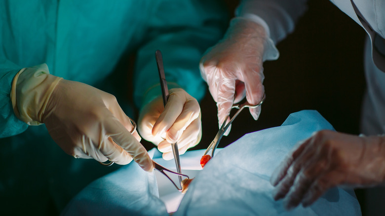 Gloved hands with surgical tools performing an operation