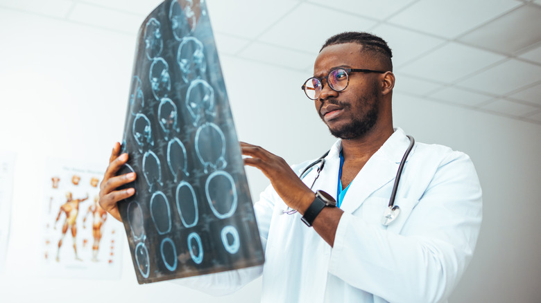 doctor examining brain x-rays