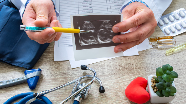 doctor displaying heart scan