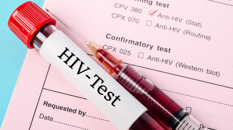 HIV test blood sample