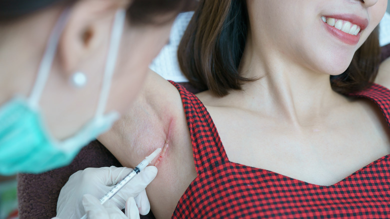 keloid treatment in woman's armpit