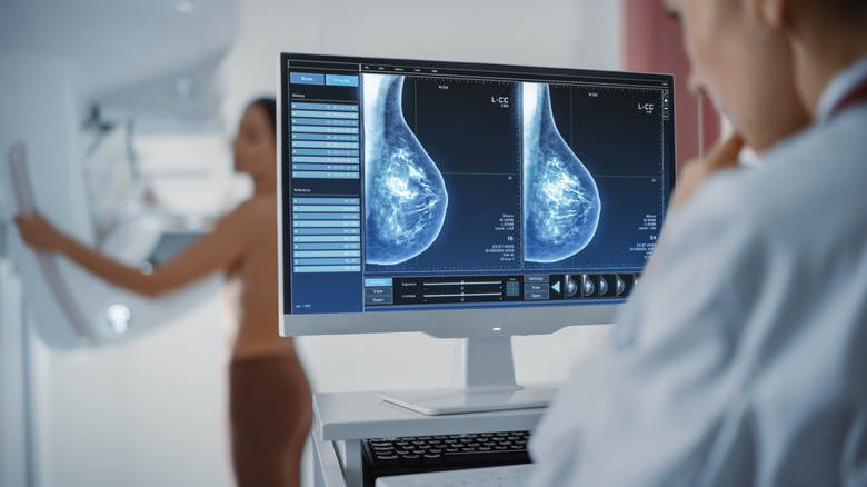 computer screen during mammogram