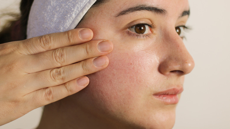 close up of rosacea skin treatment of woman