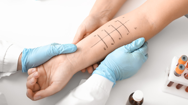 person undergoing allergen skin test