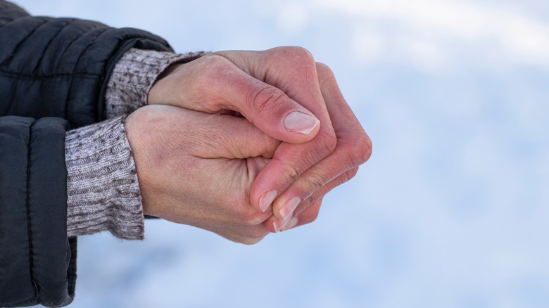 Person with red hands trying to keep warm in the cold