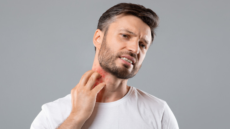 Bearded man scratching a neck rash