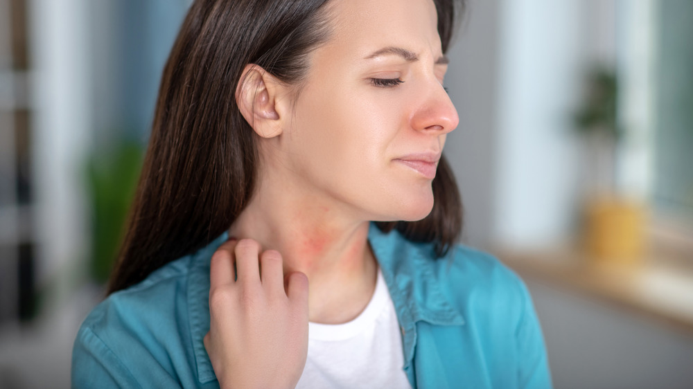 Unhappy woman touching red rash on her neck