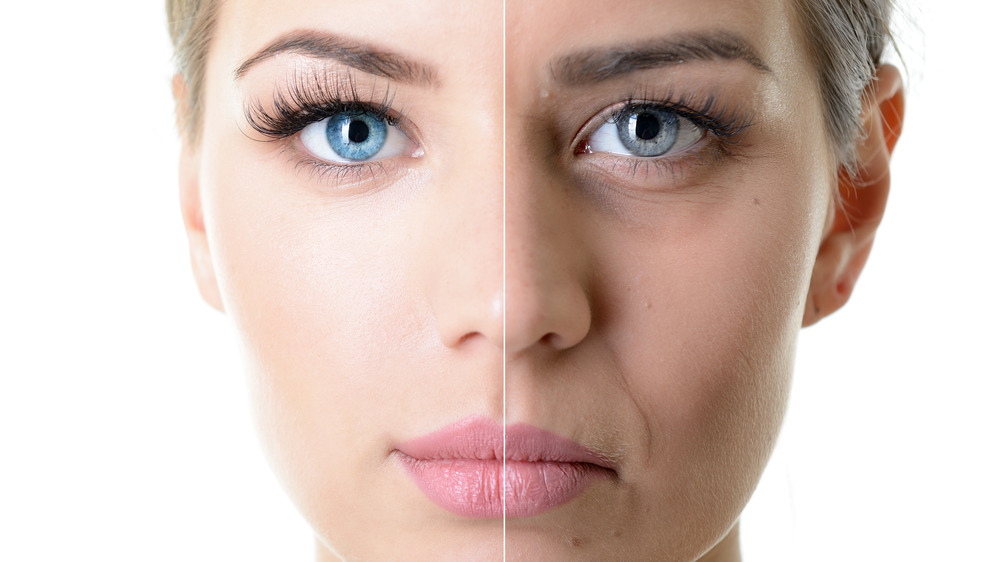 Close up of a woman's face; one side is wrinkle free, but the other side has wrinkles