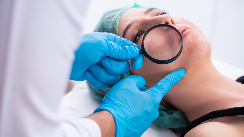 Woman with blisters on face being examined by doctor with magnifying glass