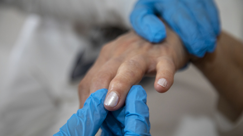 doctor examining patient's hand