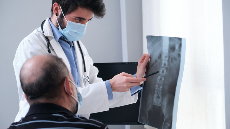 Doctor showing patient spine X-ray