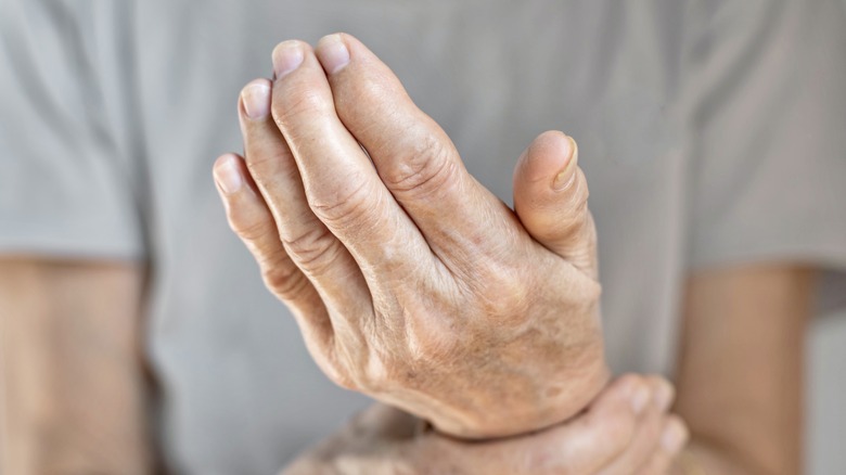 hands with swelling