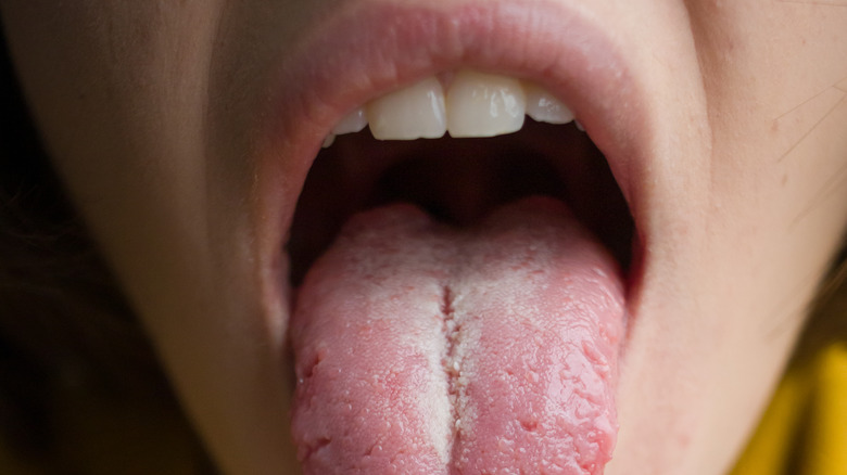 doctor looking at patient tongue