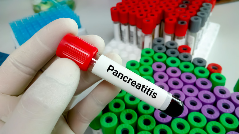 test tube with blood sample for pancreatitis test