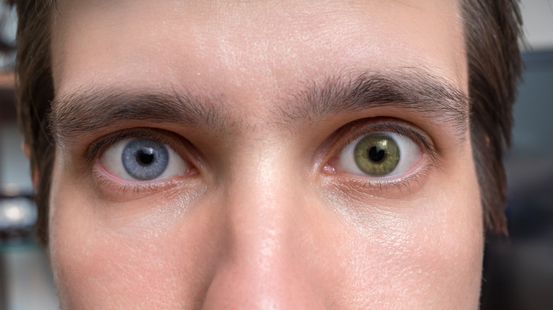 Young man with different colored eyes