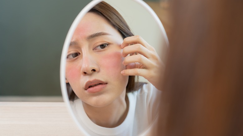 Woman looking at skin rash in mirror