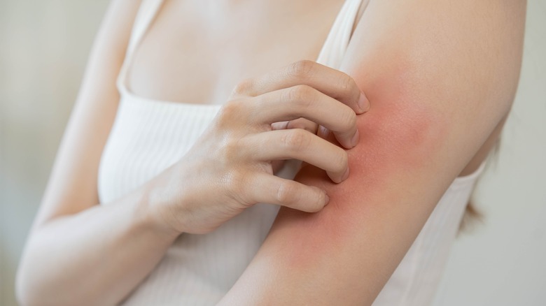 woman scratching her arm