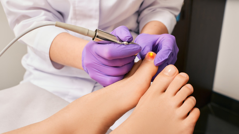 is-laser-therapy-effective-for-toenail-fungus