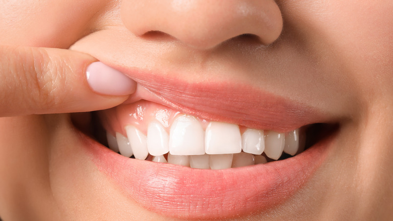 Young woman with healthy gums, closeup