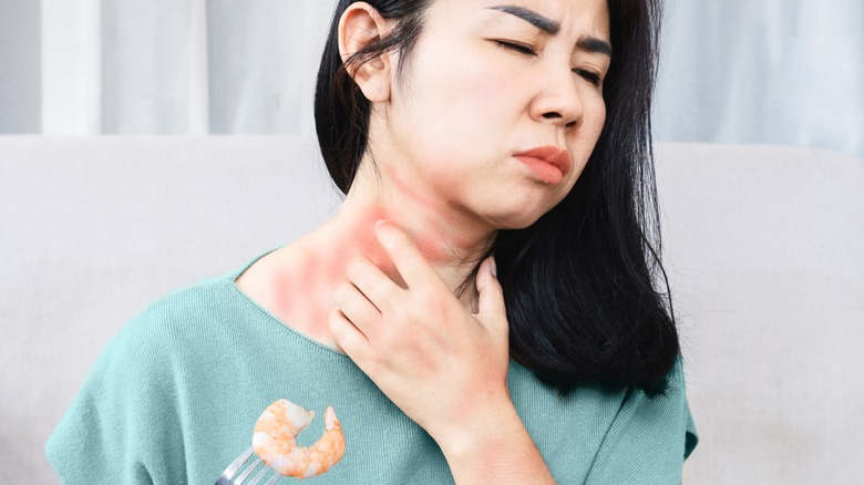 Woman scratching neck with hives