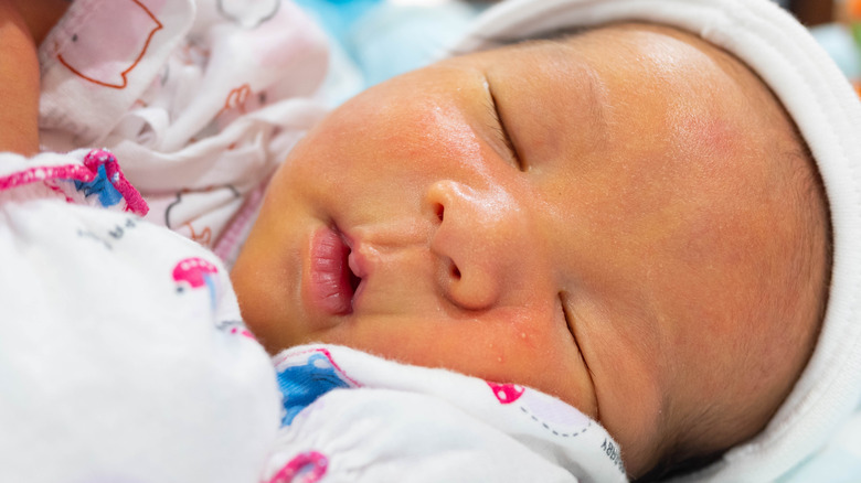 sleeping baby with neonatal jaundice