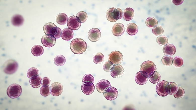 bacterial meningitis