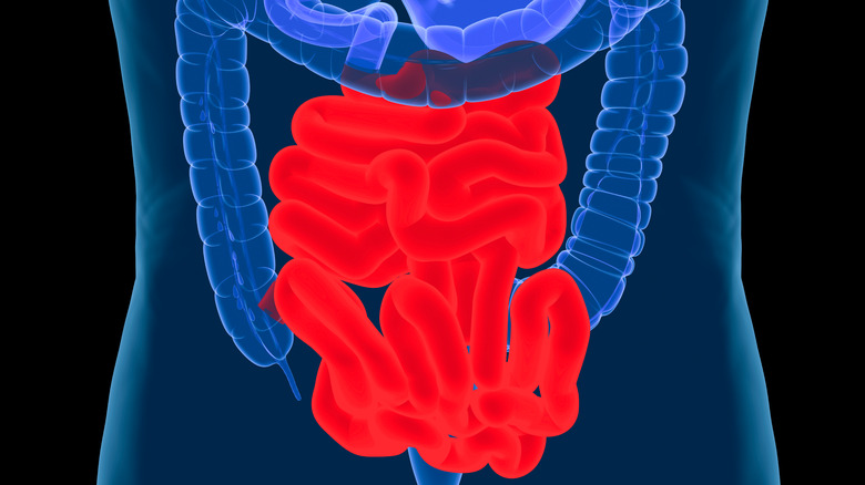 x-ray of small intestine