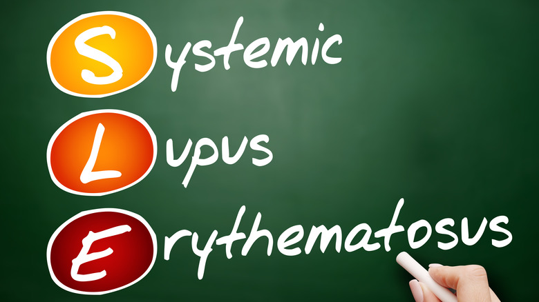 Systemic Lupus Erythematosus written out