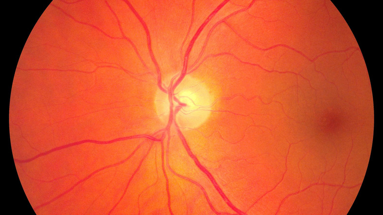 closeup image of retina