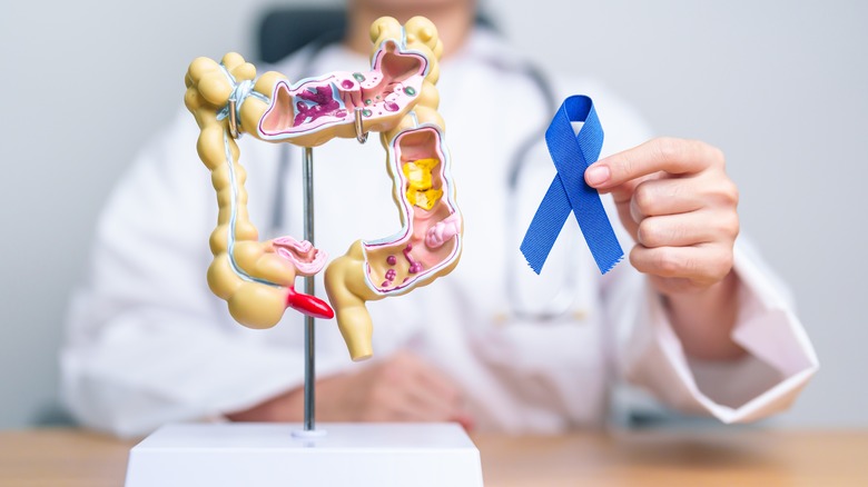 Doctor holding blue ribbon with colon model