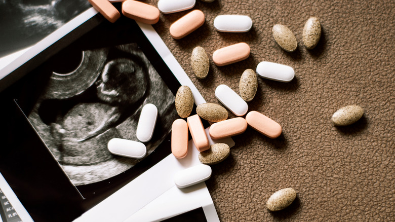 Ultrasound images and pills