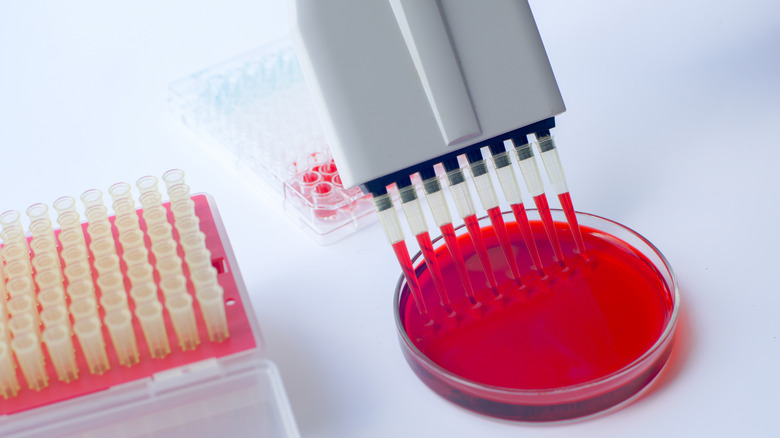 Laboratory analysis of a blood sample