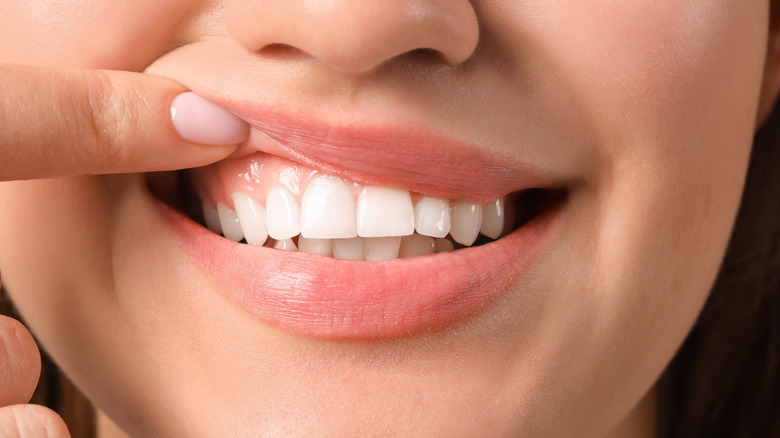 woman with healthy gums