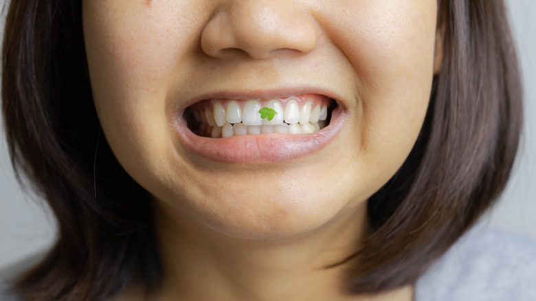 woman with food on teeth