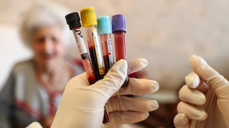 four test tubes with blood samples