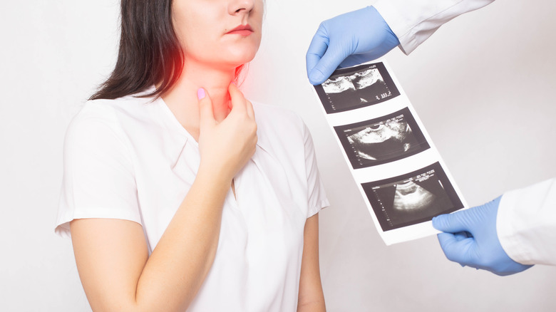 A doctor holds up thyroid ultrasound results next to a woman rubbing her neck