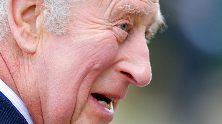 prince charles nose bump