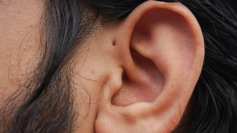 preauricular pit on man's ear