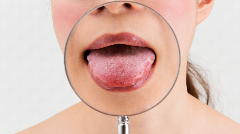 tongue seen under magnifying glass