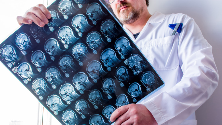 doctor examining brain scans