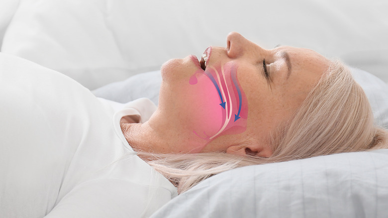 woman with sleep apnea concept