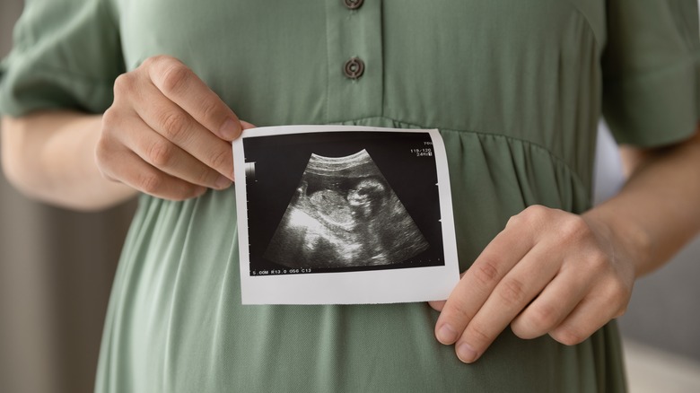woman holding ultrasound photo