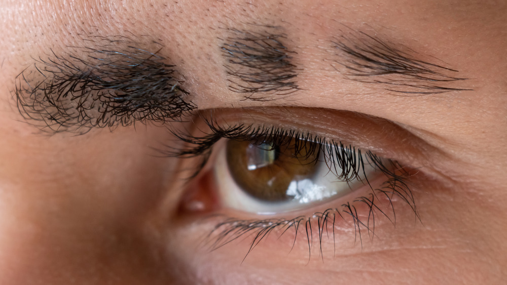 A man's eyebrow that has been shaved in two spots 