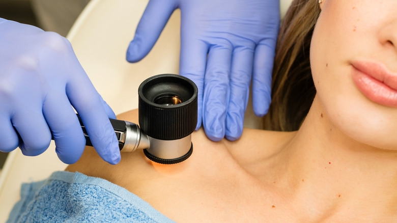 dermatologist examining mole on skin